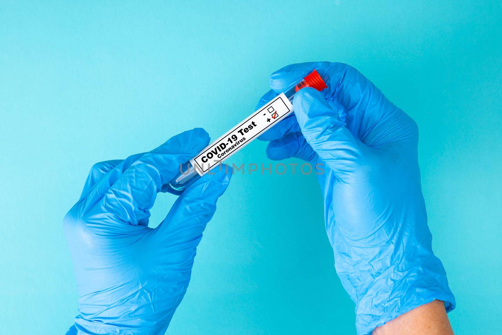 Hand in blue gloves holding a test tube sample with positive COVID-19 virus. by tehcheesiong