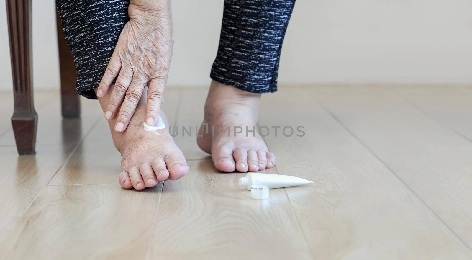 Elderly woman putting cream on swollen feet by toa55