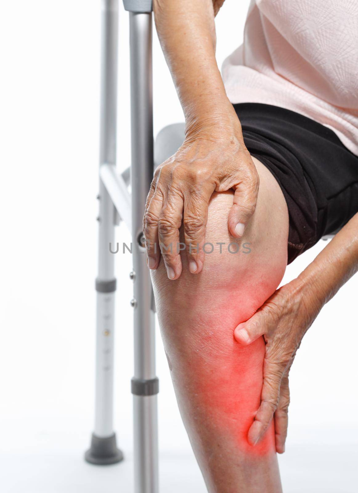 Calf pain in elderly woman