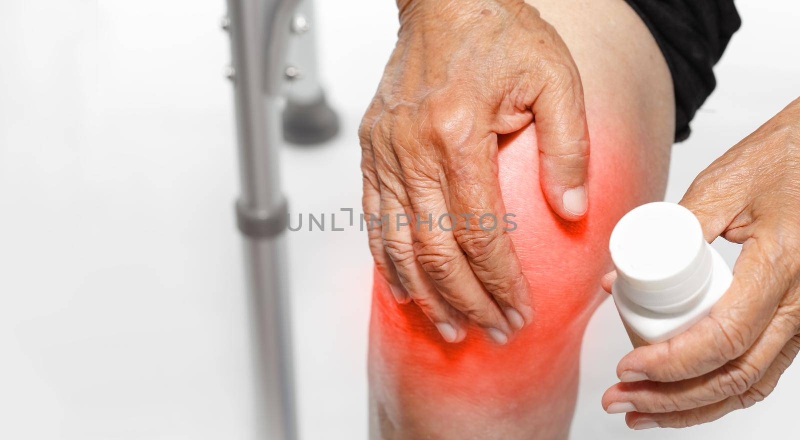 Knee Pain, Functional Impairment in Elderly by toa55