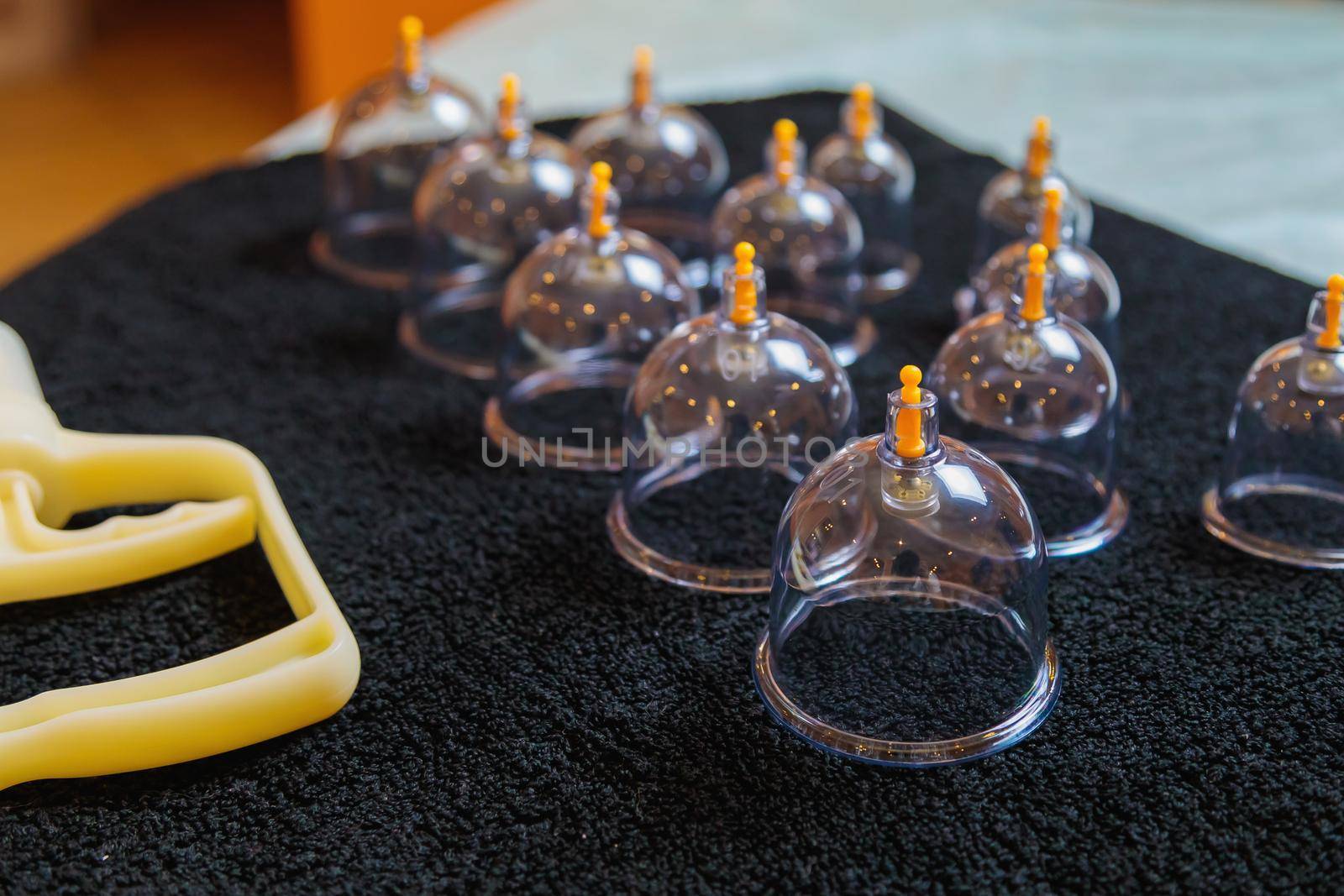 Vacuum vessels for the curative procedure of hijama bloodletting. Bloodletting, phlebotomy, sucking out dead blood cells