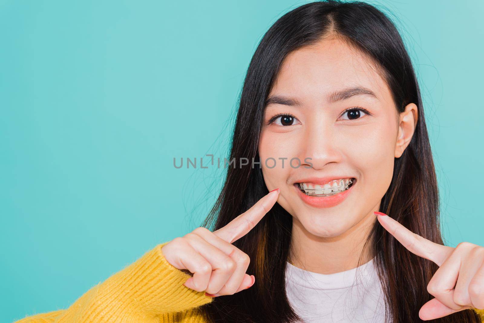 young woman teen pointing finger to teeth by Sorapop