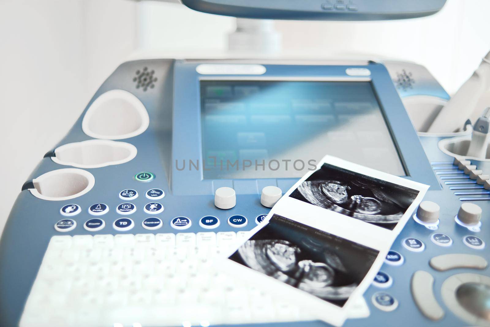 Ultrasound scanning machine at the clinic by SerhiiBobyk