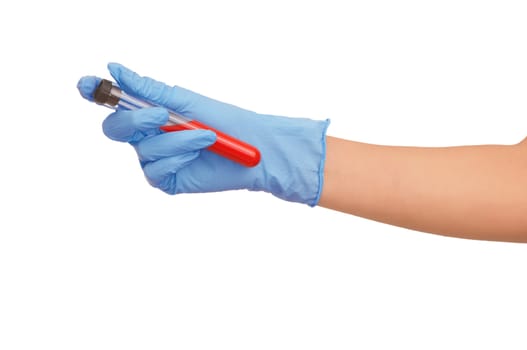 doctor holds a tube with probe of good blood for antidote