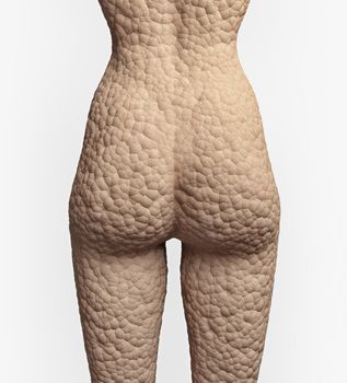 cellulite texture on the human skin (illustrationconcept)