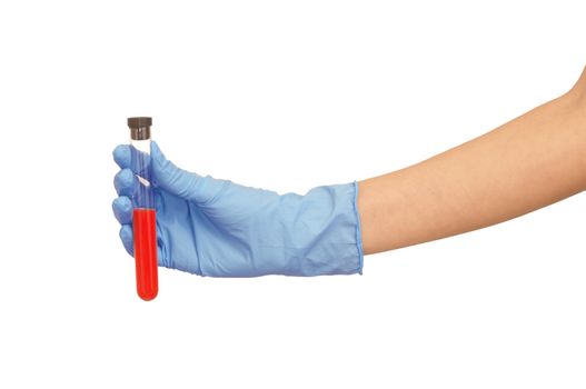 Doctor in blue gloves will be carry out research a samples of bloods at inhabitants of coast on availability of poisoning