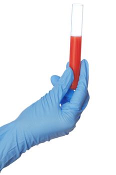 Doctor in blue gloves will be carry out research a samples of bloods at inhabitants of coast on availability of poisoning