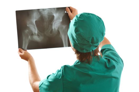 Doctor looking at x-ray (isolated on white)
