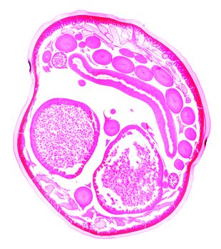 Ascaris under the microscope, background
