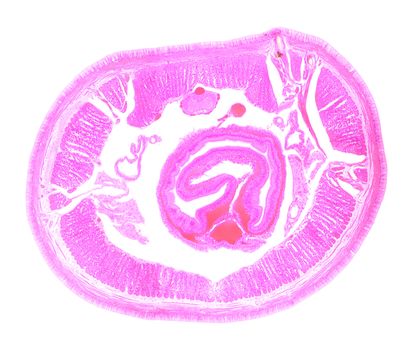 Earthworm under the microscope, background. (Lumbricidae)
