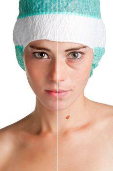 Before and after portrait of a young woman that undergone a skin treatment