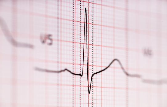 Closeup view of ECG graph. Electrocardiograph