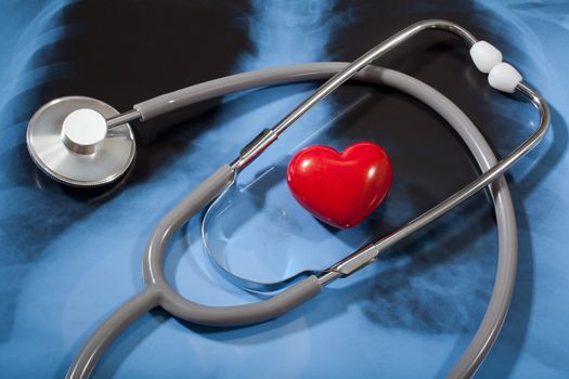 Stethoscope and red heart on X-ray