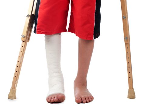 A boy with a right leg fracture struggles to walk with two crutches.