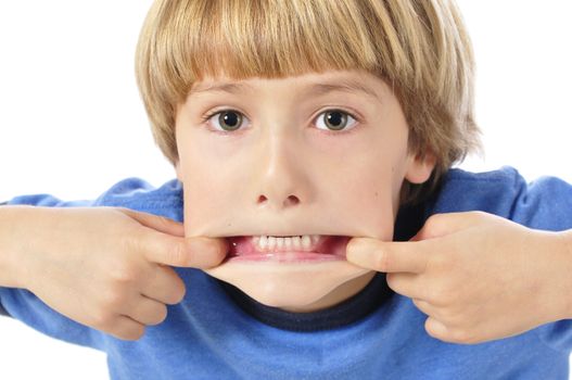 Young child making funny face by pulling mouth open shows bottom teeth