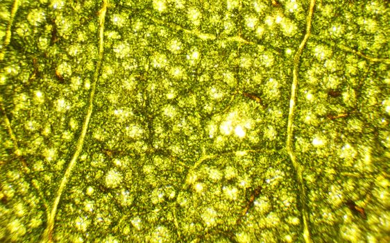 Hibiscus needles under the microscope, background. (Hibiscus)
