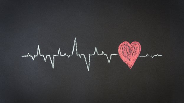 Chalk Illustration of a Heartbeat Diagram. 