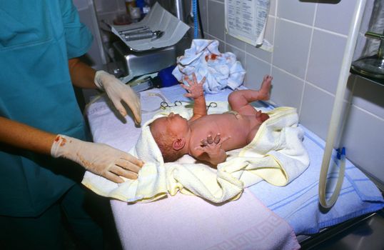 baby after birth in hospital, perinatal