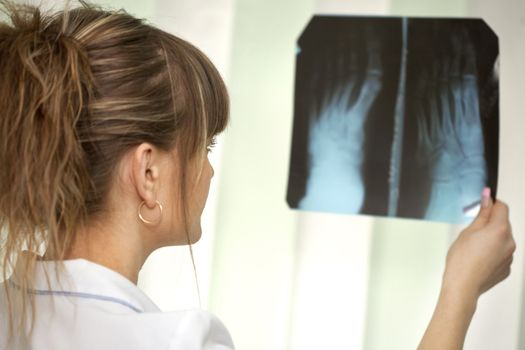 Female doctor looking at a lungs or torso xray