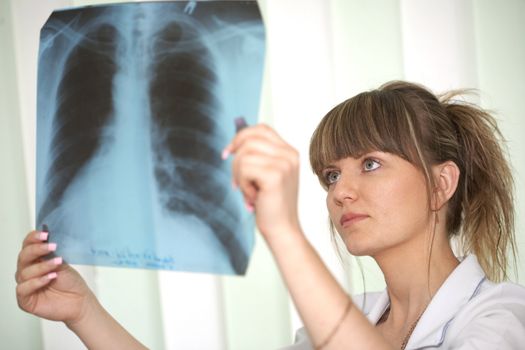 Female doctor looking at a lungs or torso xray