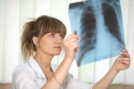 Sickness. Female doctor looking at a lungs or torso xray