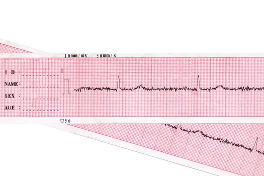 Heart. Medical inspection and health. Heart analysis scheme. Cardiogram 