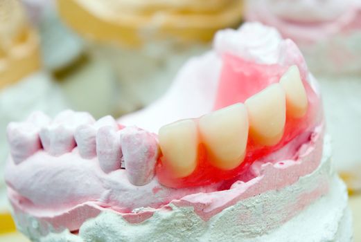 teeth mold and prosthetic devices. cabinet to stomatologies