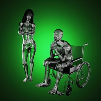 Man in wheelchair made in 3D