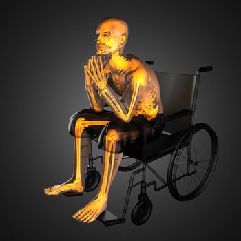 Man in wheelchair made in 3D