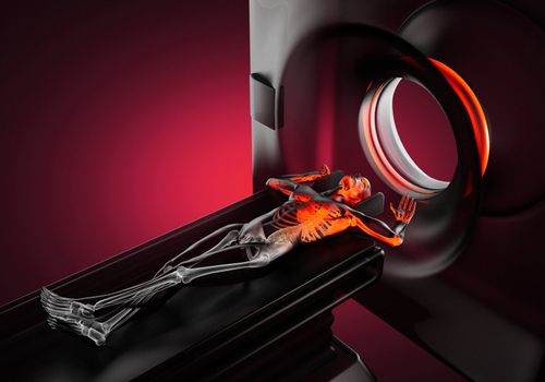 MRI examination made in 3D graphics