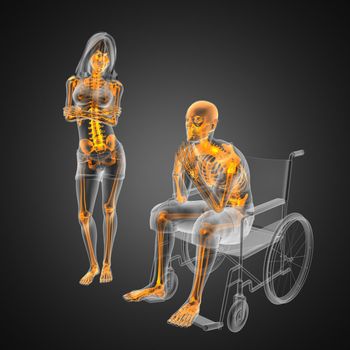 Man in wheelchair made in 3D