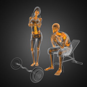 Man in wheelchair made in 3D