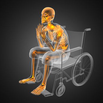 Man in wheelchair made in 3D