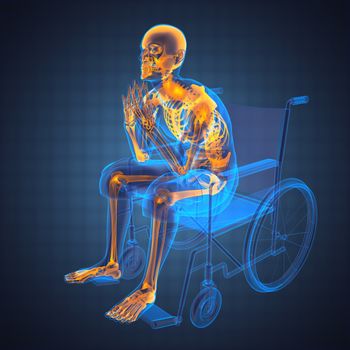 Man in wheelchair made in 3D