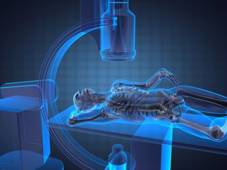 x-ray examination made in 3D graphics