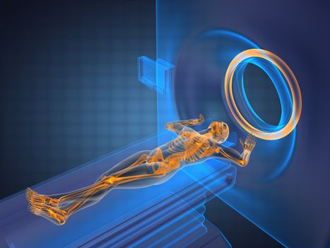 MRI examination made in 3D graphics
