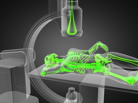 x-ray examination made in 3D graphics