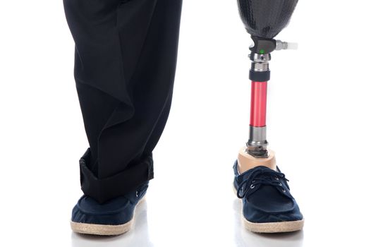 An adult man with a below knee amputation stands upright with his new prosthetic leg.