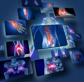 Human joints concept with the skeleton anatomy of the body with a group of panels of sore joints glowing as a pain and injury or arthritis illness symbol for health care and medical symptoms.