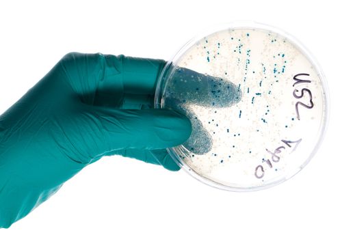 Hand in nitril glove holds Petri dish with bacterial colonies