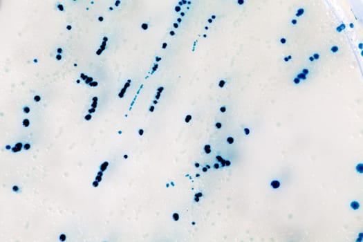 a Petri Dish with growing Virus and bacteria cells. microorganism
