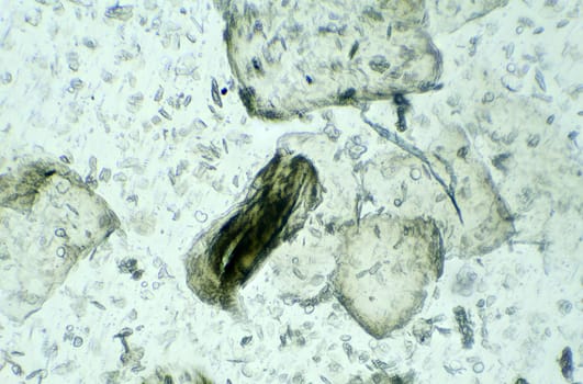 Skin under the microscope, background
