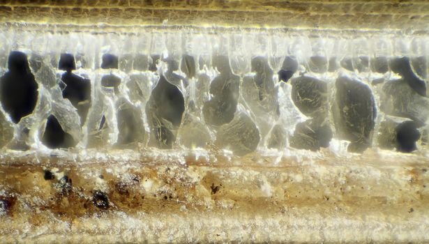 Needle hedgehog under the microscope, background (Erinaceus europaeus)
