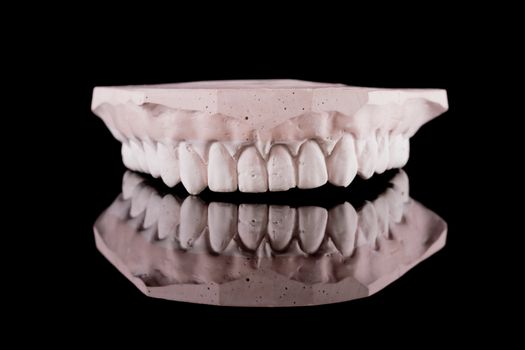 gypsum model of a human teeth on black background