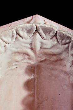 gypsum model of a human teeth on black background