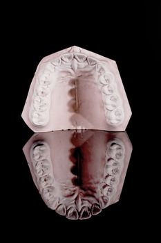 gypsum model of a human teeth on black background