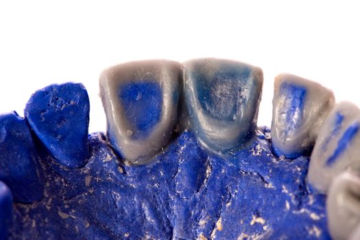 gypsum model of a human teeth on white background