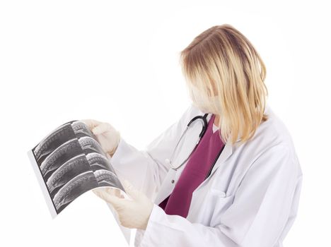 Medical doctor with radiograph