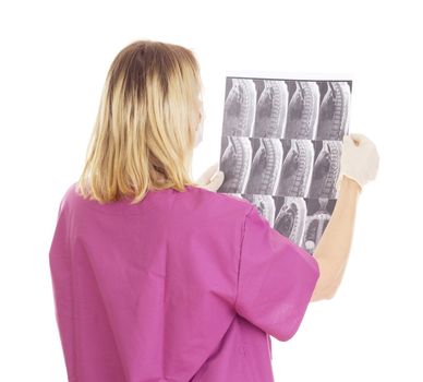 Medical doctor with radiograph
