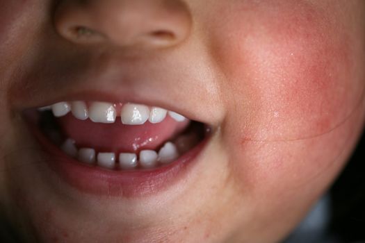  close up of child mouth while laughing